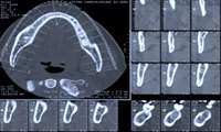 برگزاری برنامه CBCT ویژه دندانپزشکان در 28 مرداد ماه